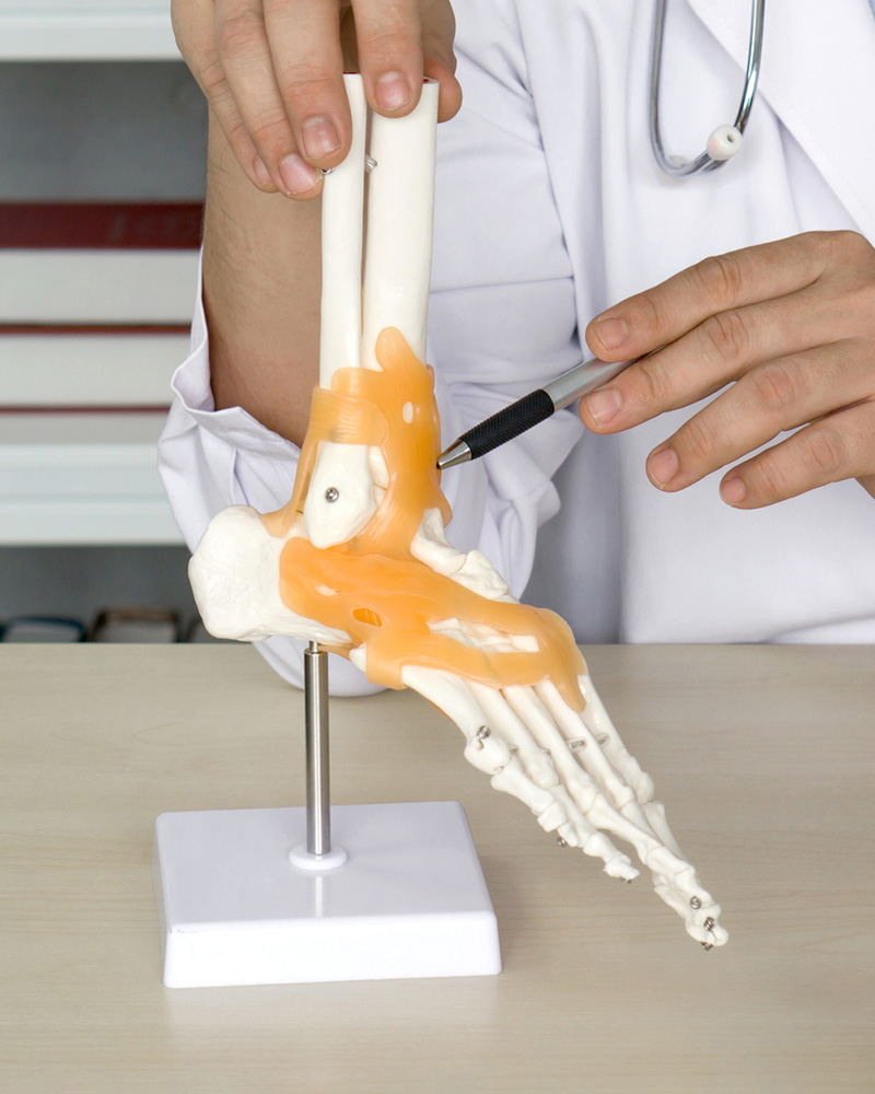 Ankle Ligament Surgery