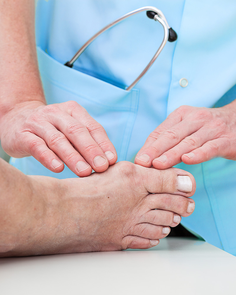 Bunion Surgery – Day of Surgery