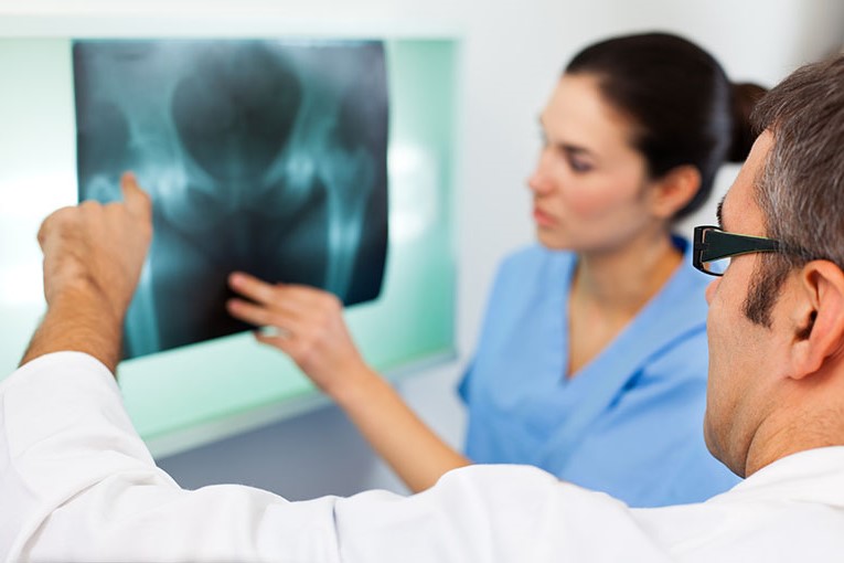 two specialists examine an x-ray