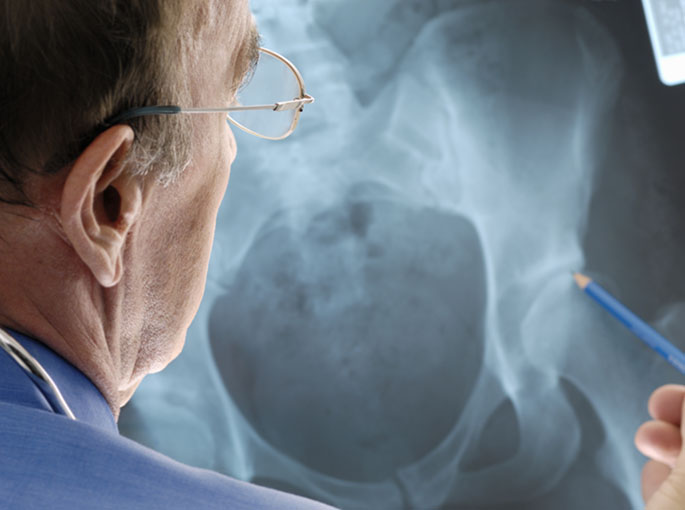 orthopaedics hip replacement partial xray