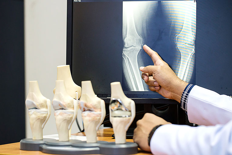 orthopaedics knee replacement