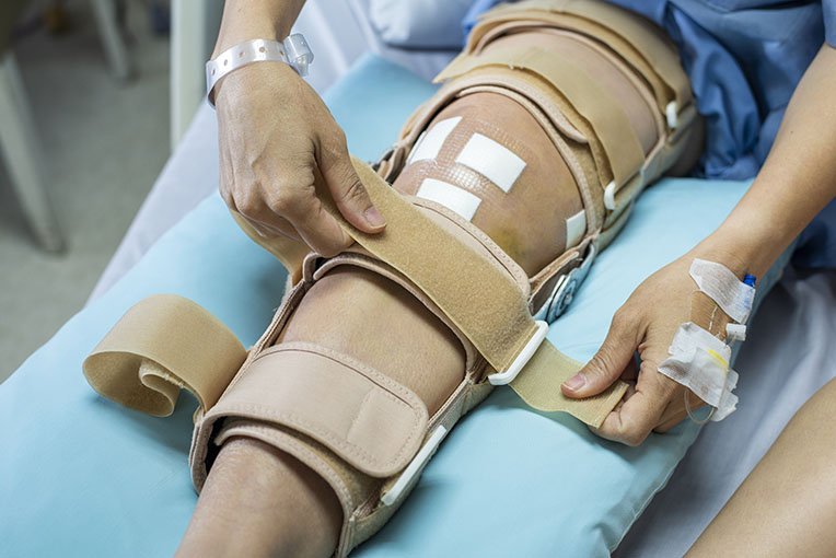 The anterior cruciate ligament (ACL) plays an important role in stabilising the knee joint, particularly for rotational movements.