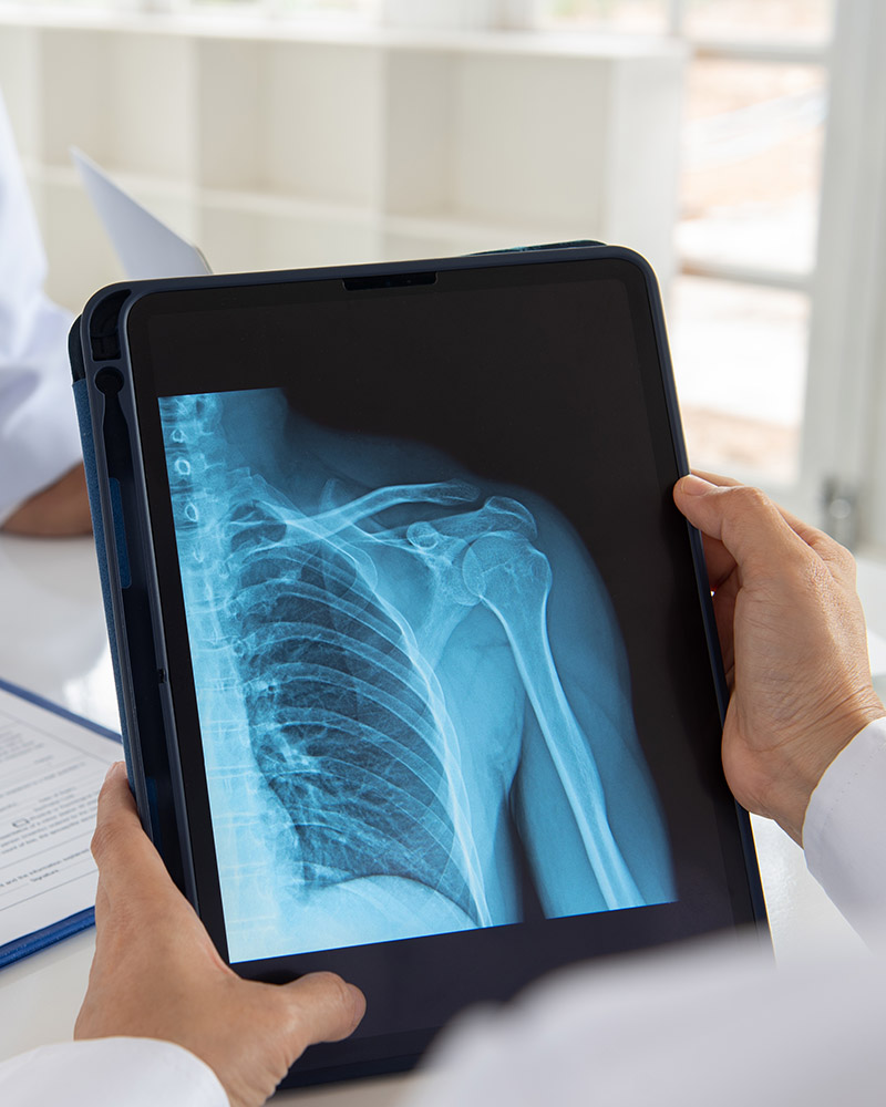 Common Shoulder Conditions