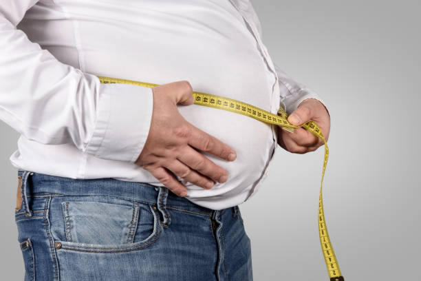 Dr Craig Taylor discusses Bariatric Surgery